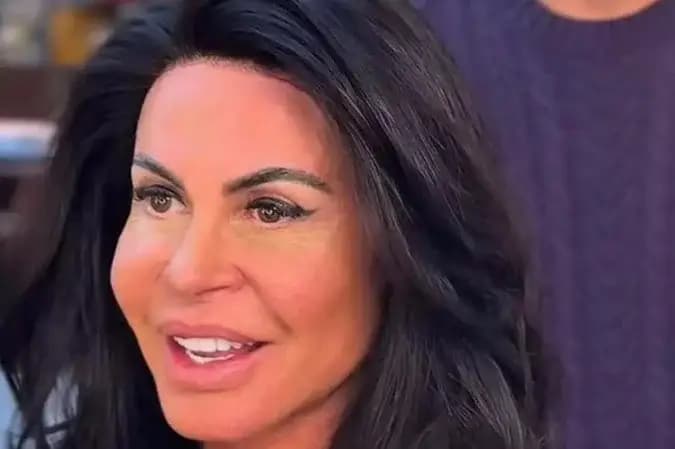 Gretchen choca ao revelar rotina para esconder alopecia do marido