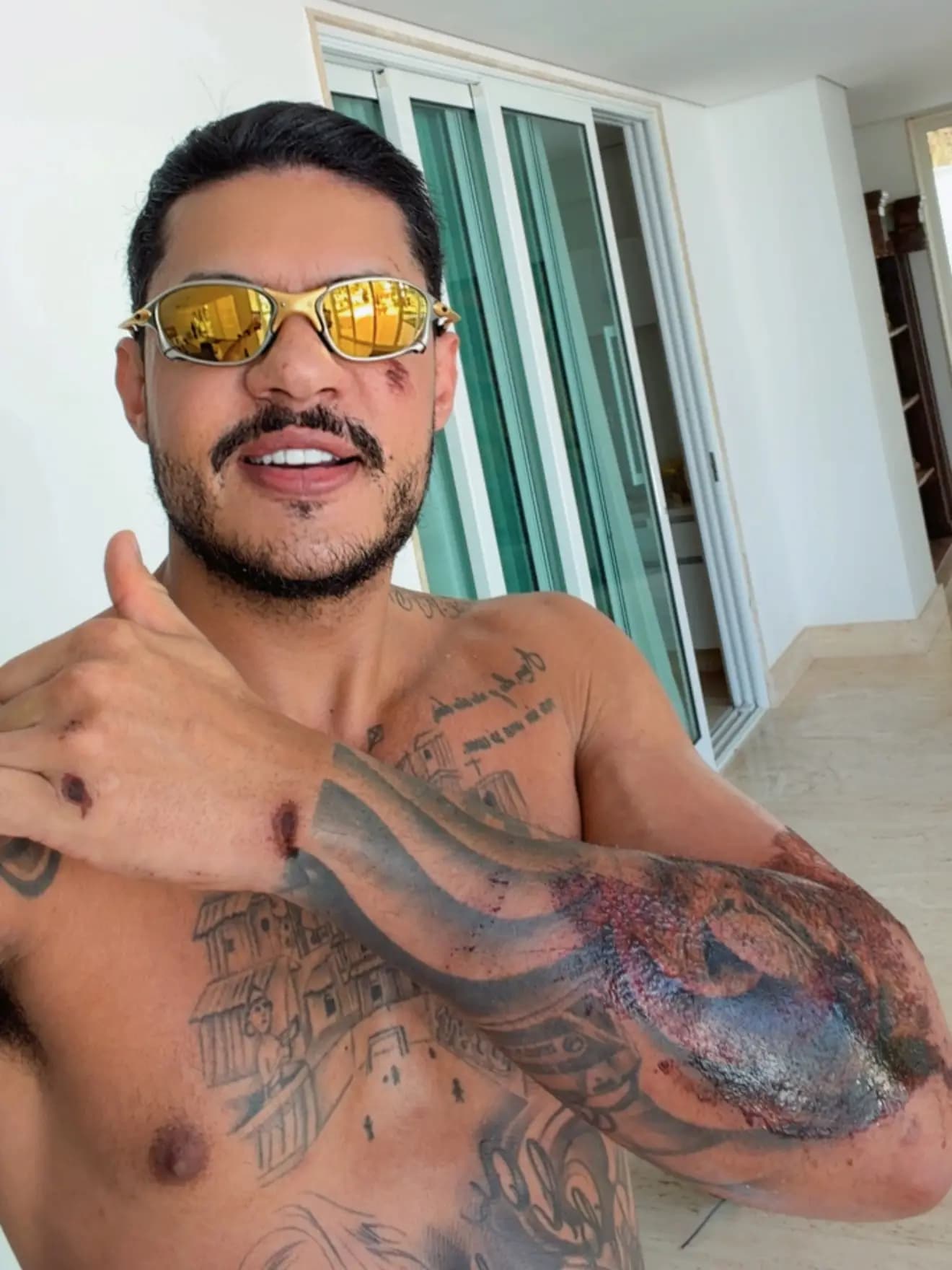 Rapper Hungria sofre acidente de moto e tranquiliza fãs na web