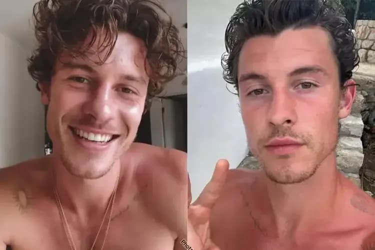Shawn Mendes sofre queda e é levado ao hospital com Bruna Marquezine