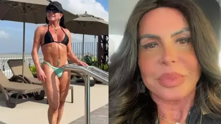 Aos 65, Gretchen surpreende ao falar de cirurgia íntima após emagrecimento